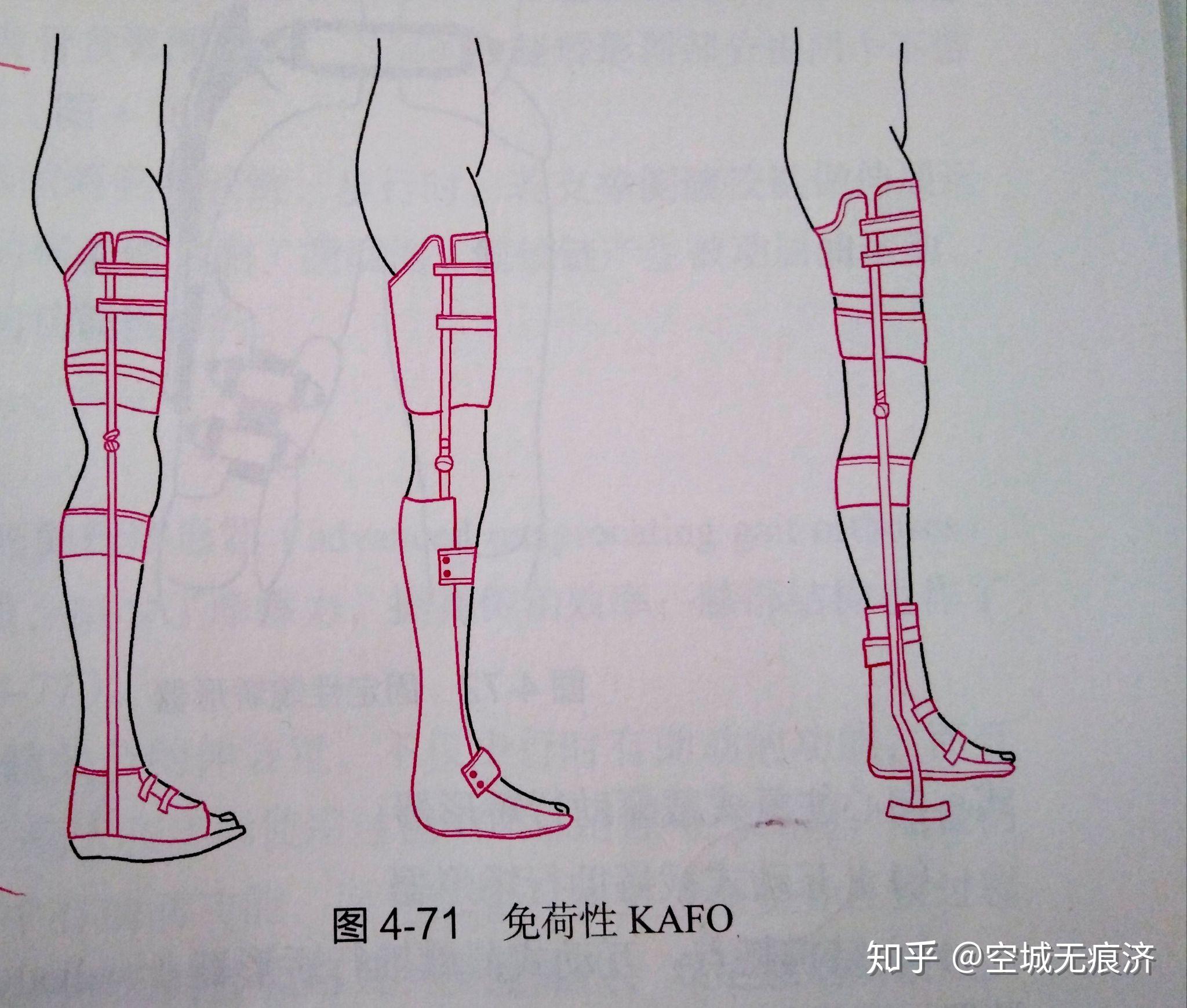 臨床康復工程學 假肢與矯形器的功能、設計與發展